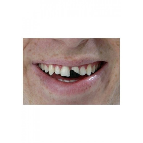 Dente Quebrado Lóide Luxo Os Debilóides Adulto